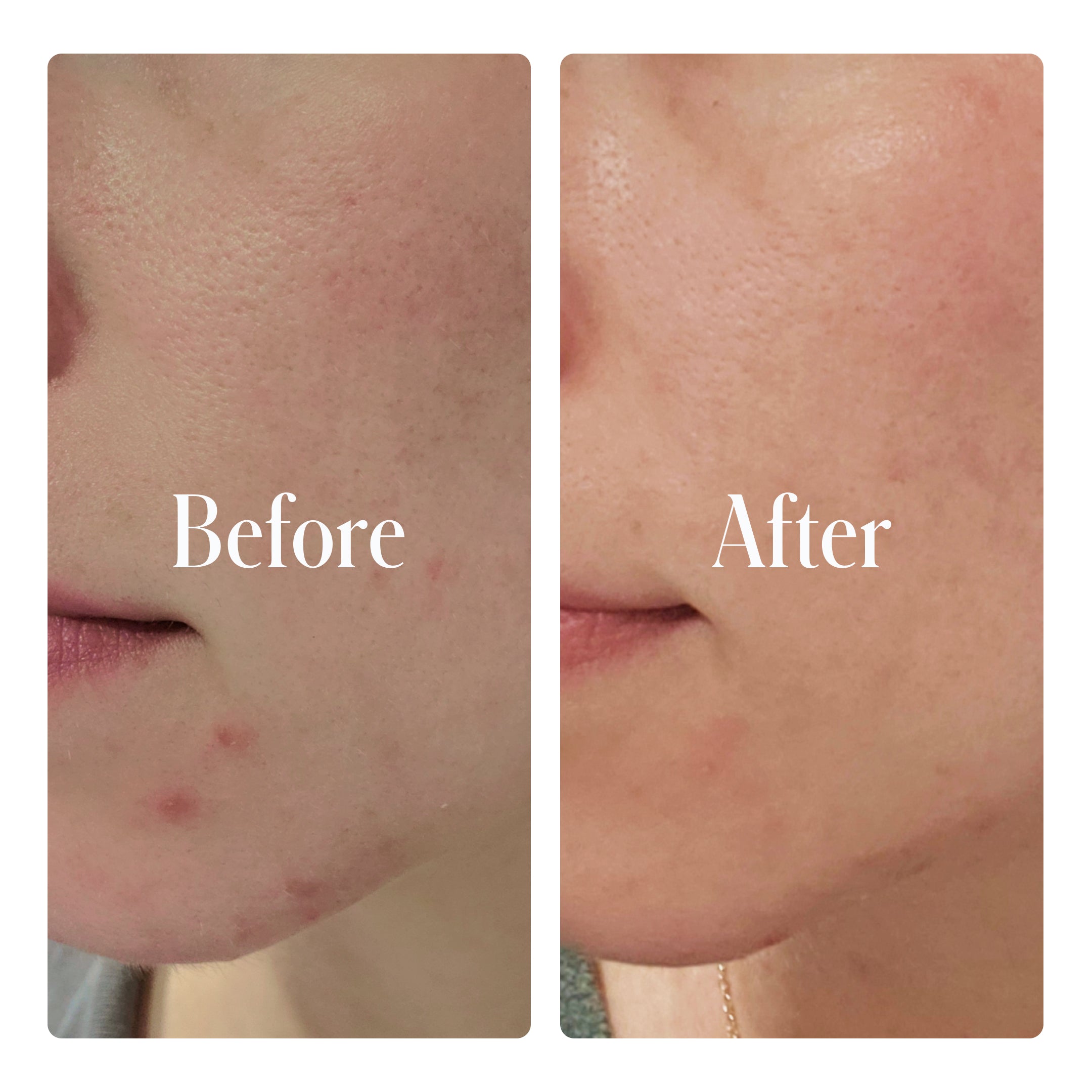 Clear System Full Routine